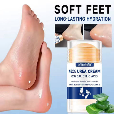 Whizzhop™ Urea Foot and Hand Cream – 42% Urea and 2% Salicylic Acid for Dry Skin