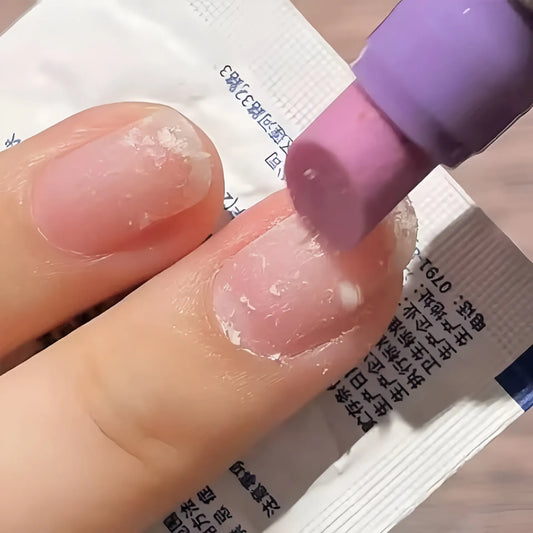Whizzhop™ 3-in-1 Cuticle Care Pen – Nourishing Cuticle Oil and Nail Care Treatment for Dry Nails