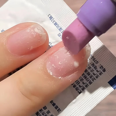 Whizzhop™ 3-in-1 Cuticle Care Pen – Nourishing Cuticle Oil and Nail Care Treatment for Dry Nails