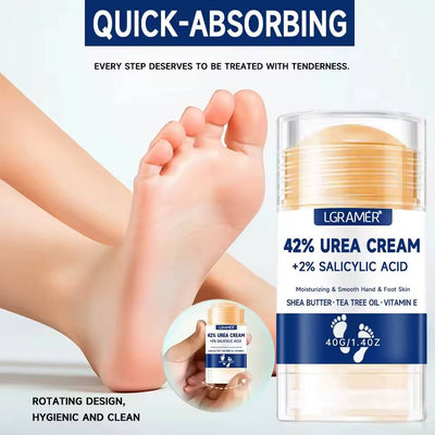 Whizzhop™ Urea Foot and Hand Cream – 42% Urea and 2% Salicylic Acid for Dry Skin