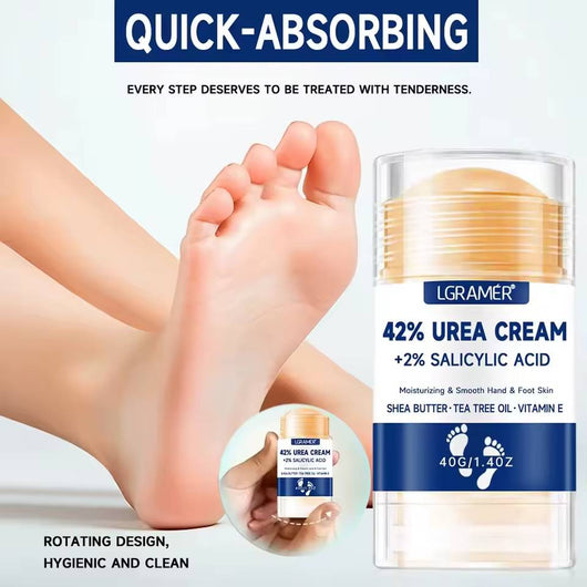 Whizzhop™ Urea Foot and Hand Cream – 42% Urea and 2% Salicylic Acid for Dry Skin