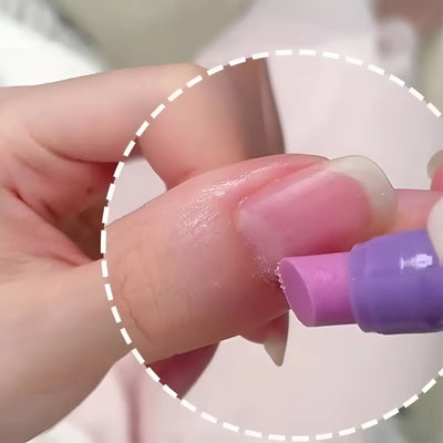 Whizzhop™ 3-in-1 Cuticle Care Pen – Nourishing Cuticle Oil and Nail Care Treatment for Dry Nails