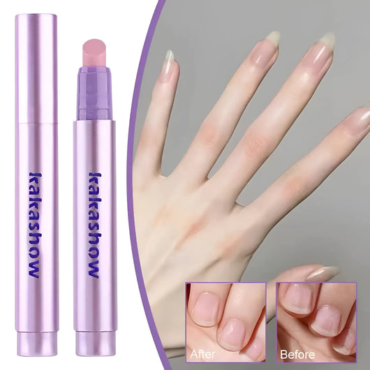 Whizzhop™ 3-in-1 Cuticle Care Pen – Nourishing Cuticle Oil and Nail Care Treatment for Dry Nails