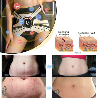 Whizzhop™ Medical Grade Titanium Fiber Tourmaline Shaping Shorts