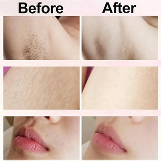 Whizzhop® Razor - Shaving innovation for smooth, healthy skin