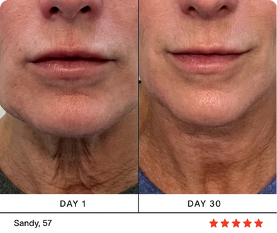 The 4-in-1 Radiant Renewal Wand (Red Light Therapy)