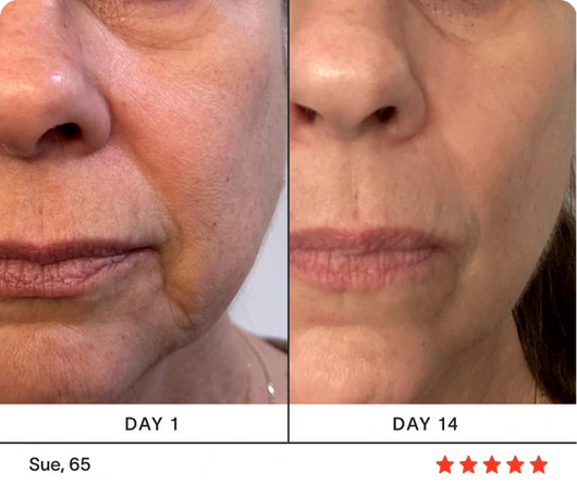 The 4-in-1 Radiant Renewal Wand (Red Light Therapy)